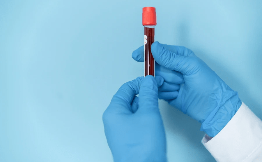 Cologuard Plus™ test | Exact Sciences