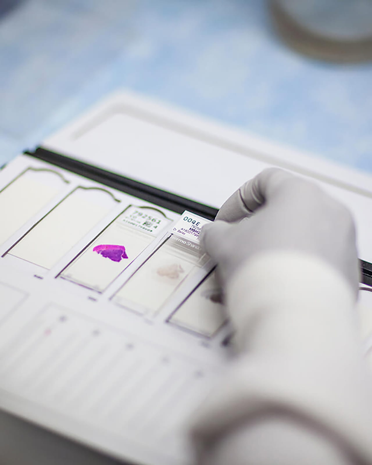 A technician's hand working with a lab sample.